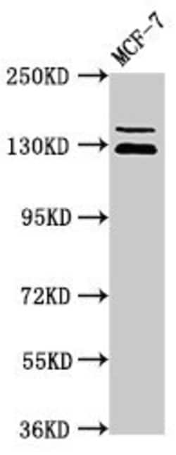 Invitrogen ZNF335 Polyclonal Antibody 100 &mu;g; Unconjugated:Antibodies,