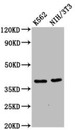 Invitrogen ZNF367 Polyclonal Antibody 100 &mu;g | Buy Online | Invitrogen&trade; | Fisher Scientific