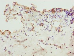 Invitrogen ZNF549 Polyclonal Antibody 100 &mu;L | Buy Online | Invitrogen&trade; | Fisher Scientific