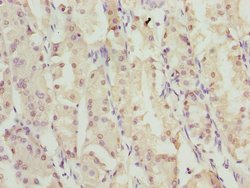 Invitrogen ZNF549 Polyclonal Antibody 100 &mu;L | Buy Online | Invitrogen&trade; | Fisher Scientific