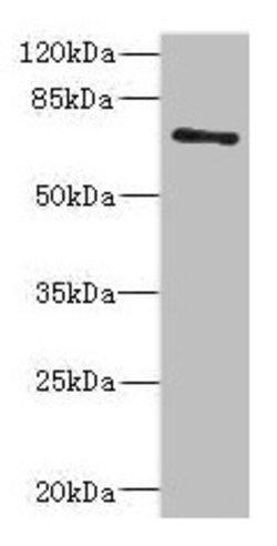 Invitrogen ZNF549 Polyclonal Antibody 100 &mu;L | Buy Online | Invitrogen&trade; | Fisher Scientific