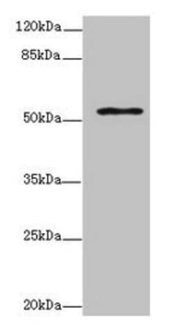 Invitrogen ZNF610 Polyclonal Antibody 100 &mu;g; Unconjugated:Antibodies,