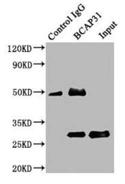 Invitrogen BAP31 Polyclonal Antibody 100 &mu;g | Buy Online | Invitrogen&trade; | Fisher Scientific