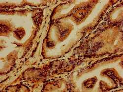 Invitrogen GABARAPL2 Polyclonal Antibody 100 &mu;g; Unconjugated:Antibodies,