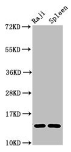 Invitrogen GABARAPL2 Polyclonal Antibody 100 &mu;g; Unconjugated:Antibodies,