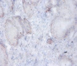 Invitrogen AFG3L2 Polyclonal Antibody 100 &mu;g; Unconjugated:Antibodies,