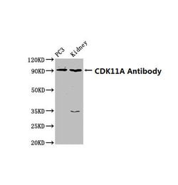 Invitrogen CDK11A Polyclonal Antibody 100 &mu;g; Unconjugated:Antibodies,