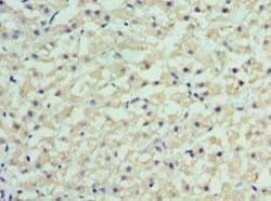 Invitrogen RBP4 Polyclonal Antibody 100 &mu;g | Buy Online | Invitrogen&trade; | Fisher Scientific