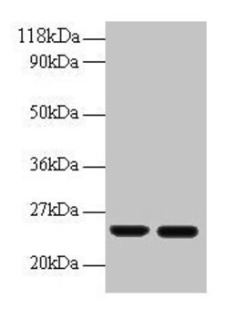Invitrogen RBP4 Polyclonal Antibody 100 &mu;g | Buy Online | Invitrogen&trade; | Fisher Scientific
