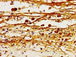 Invitrogen CD171 (L1CAM) Polyclonal Antibody 100 &mu;g; Unconjugated:Antibodies,