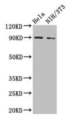 Invitrogen CD171 (L1CAM) Polyclonal Antibody 100 &mu;g; Unconjugated:Antibodies,