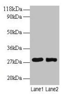 Invitrogen MPZ Polyclonal Antibody 100 &mu;g; Unconjugated:Antibodies,