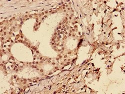Invitrogen p53 Polyclonal Antibody 100 &mu;g; Unconjugated:Antibodies,