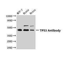 Invitrogen p53 Polyclonal Antibody 100 &mu;g; Unconjugated:Antibodies,