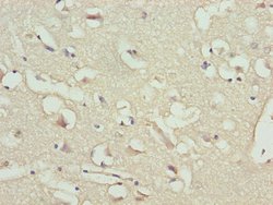 Invitrogen BNP Polyclonal Antibody 100 &mu;g | Buy Online | Invitrogen&trade; | Fisher Scientific