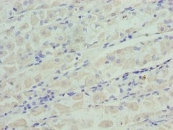 Invitrogen IGFBP-1 Polyclonal Antibody 100 &mu;g | Buy Online | Invitrogen&trade; | Fisher Scientific