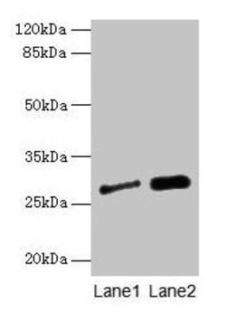 Invitrogen IGFBP-1 Polyclonal Antibody 100 &mu;g | Buy Online | Invitrogen&trade; | Fisher Scientific