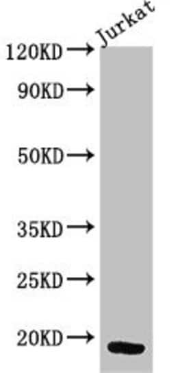 Invitrogen CD3z Polyclonal Antibody 100 &mu;g; Unconjugated:Antibodies,