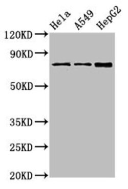 Invitrogen TGM2 Polyclonal Antibody 100 &mu;g | Buy Online | Invitrogen&trade; | Fisher Scientific