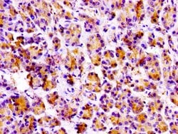 Invitrogen PRSS3 Polyclonal Antibody 100 &mu;g; Unconjugated:Antibodies,