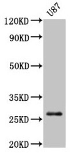 Invitrogen PRSS3 Polyclonal Antibody 100 &mu;g; Unconjugated:Antibodies,