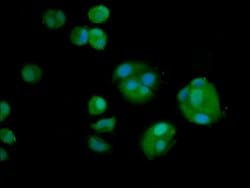 Invitrogen AMH Polyclonal Antibody 100 &mu;g; Unconjugated:Antibodies,