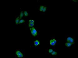 Invitrogen IL17RA Polyclonal Antibody 100 &mu;g; Unconjugated:Antibodies,