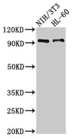 Invitrogen IL17RA Polyclonal Antibody 100 &mu;g; Unconjugated:Antibodies,