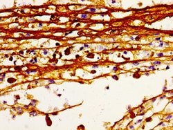 Invitrogen HDC Polyclonal Antibody 100 &mu;g; Unconjugated:Antibodies,