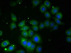 TROVE2 Polyclonal Antibody:Antibodies, Polyclonal