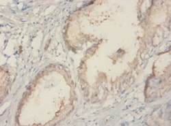 TROVE2 Polyclonal Antibody:Antibodies, Polyclonal