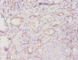 TROVE2 Polyclonal Antibody:Antibodies, Polyclonal