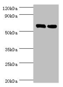 TROVE2 Polyclonal Antibody:Antibodies, Polyclonal
