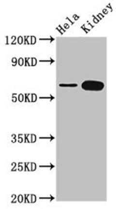TROVE2 Polyclonal Antibody:Antibodies, Polyclonal