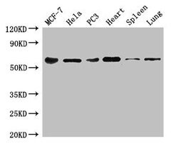 TROVE2 Polyclonal Antibody:Antibodies, Polyclonal