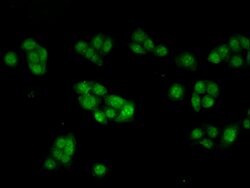 Invitrogen INHBB Polyclonal Antibody 100 &mu;g; Unconjugated:Antibodies,