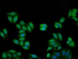 Invitrogen Kininogen Light Chain Polyclonal Antibody 100 &mu;g; Unconjugated:Antibodies,