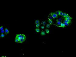 Invitrogen CHRNB1 Polyclonal Antibody 100 &mu;g; Unconjugated:Antibodies,