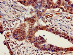 Invitrogen CHRNB1 Polyclonal Antibody 100 &mu;g; Unconjugated:Antibodies,