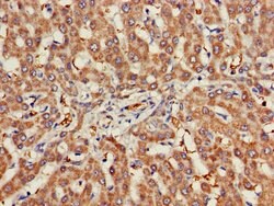 Invitrogen CHRNB1 Polyclonal Antibody 100 &mu;g; Unconjugated:Antibodies,