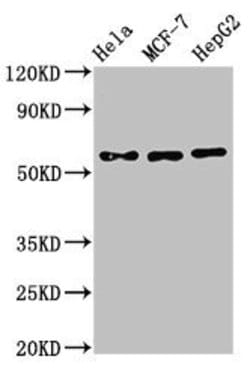 Invitrogen CHRNB1 Polyclonal Antibody 100 &mu;g; Unconjugated:Antibodies,