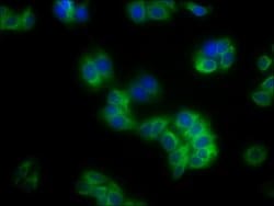 Invitrogen HLA-B Polyclonal Antibody 100 &mu;g; Unconjugated:Antibodies,