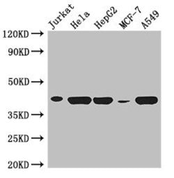 Invitrogen HLA-B Polyclonal Antibody 100 &mu;g; Unconjugated:Antibodies,