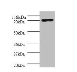 Invitrogen POLA1 Polyclonal Antibody 100 &mu;g | Buy Online | Invitrogen&trade; | Fisher Scientific