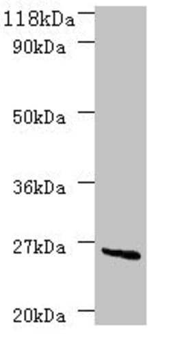 Invitrogen deoD Polyclonal Antibody 100 &mu;g | Buy Online | Invitrogen&trade; | Fisher Scientific