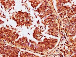 Invitrogen CABIN1 Polyclonal Antibody 100 &mu;g; Unconjugated:Antibodies,