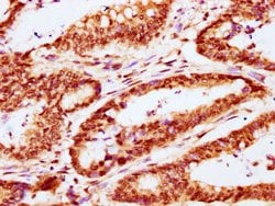 Invitrogen CABIN1 Polyclonal Antibody 100 &mu;g; Unconjugated:Antibodies,
