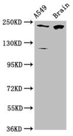 Invitrogen CABIN1 Polyclonal Antibody 100 &mu;g; Unconjugated:Antibodies,