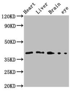 Invitrogen FAS (CD95) Polyclonal Antibody 100 &mu;L; Unconjugated:Antibodies,