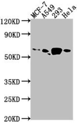 PDE1B Polyclonal Antibody, Invitrogen 100 &mu;L; Unconjugated:Antibodies,